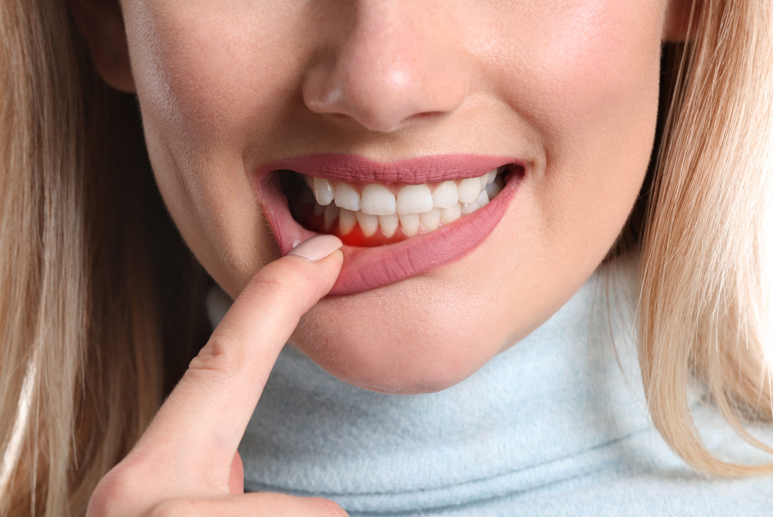 THE ART OF GUM REJUVENATION
