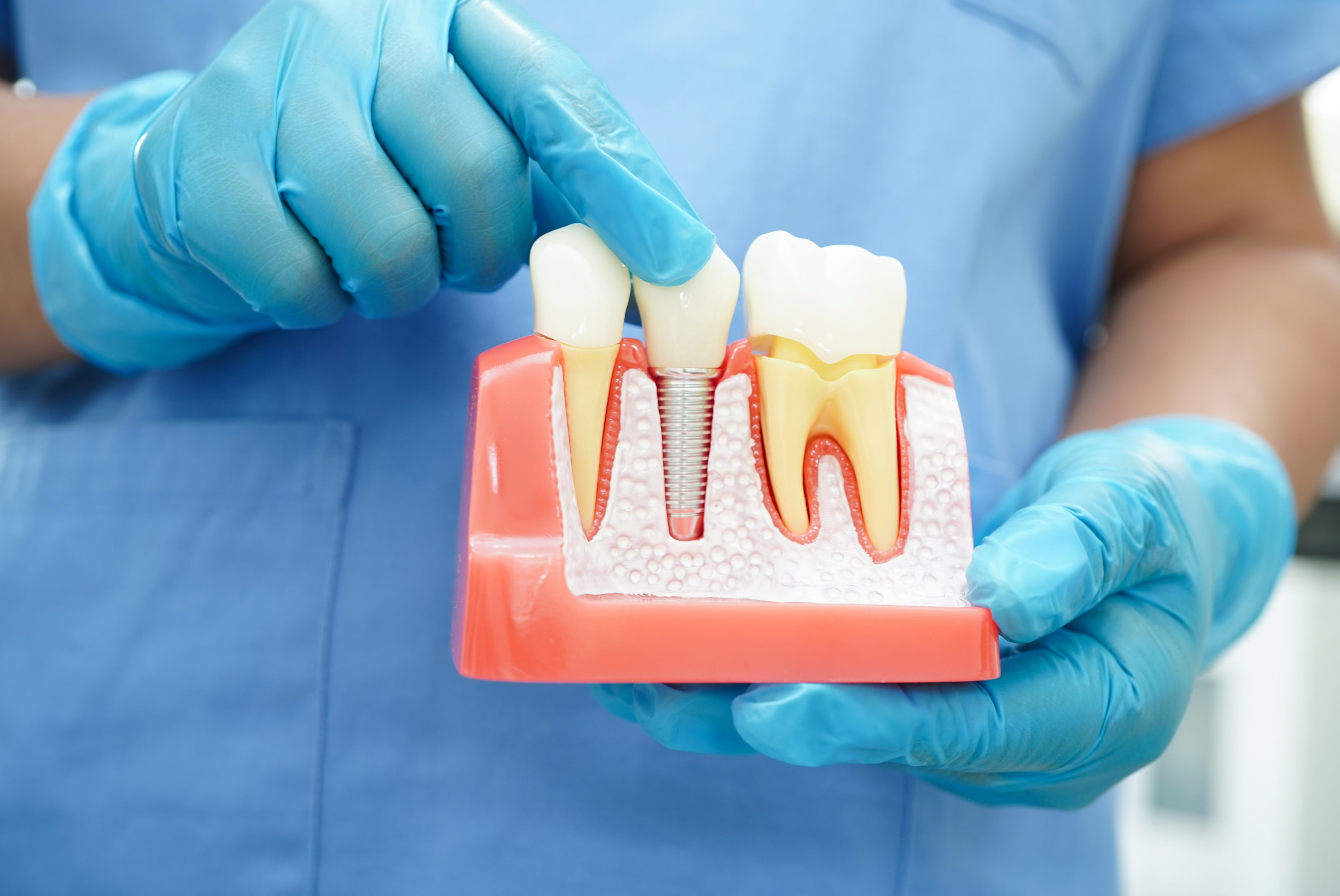 RESTORING GUM HEALTH