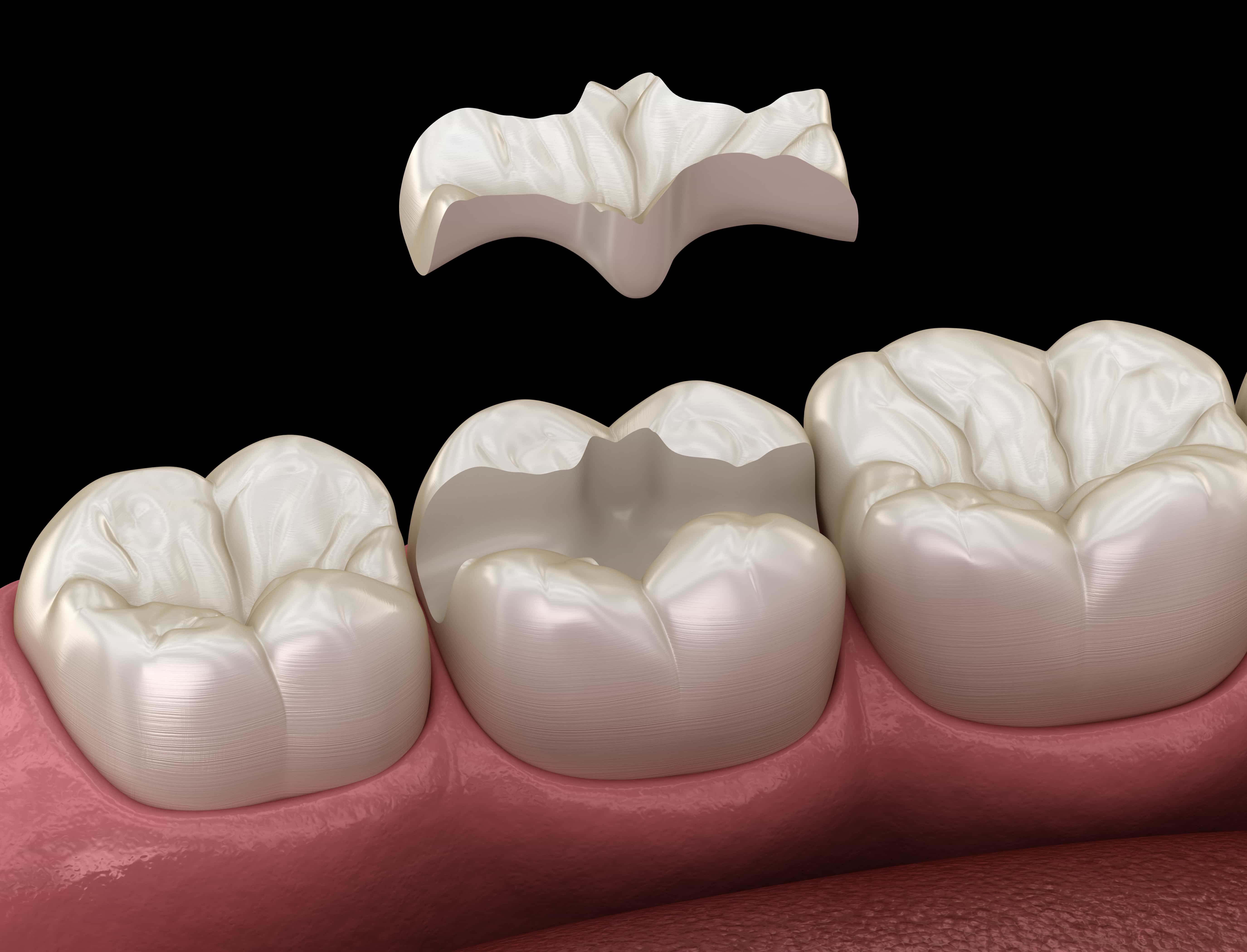 TAILORED RESTORATION FOR LASTING BEAUTY